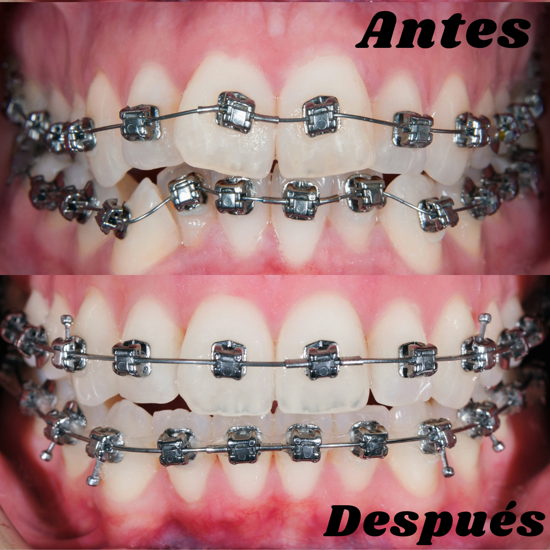 orto 4